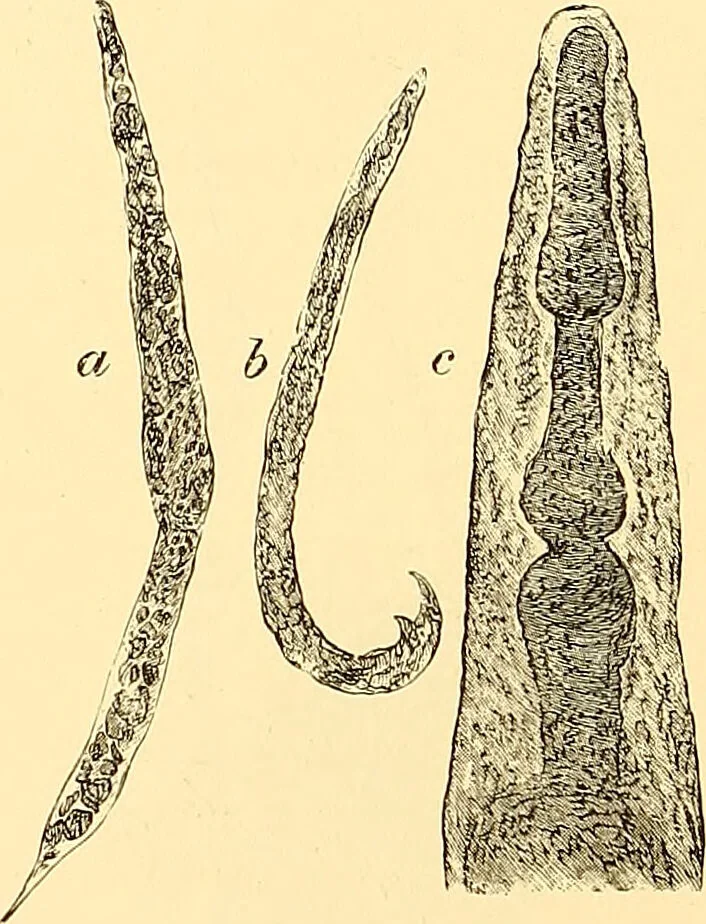 An illustration from Clinical diagnosis : the bacteriological, chemical, and microscopical evidence of disease / by Rudolf v. Jaksch ; tr. from the 3rd German ed. and enlarged by James Cagney ; with numerous illustrations (partly in colours)., 1893, leaf 222