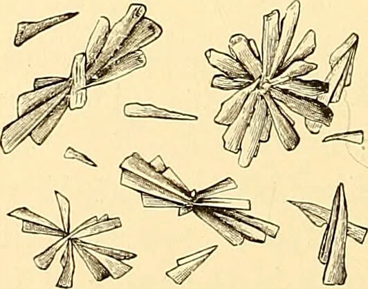 An illustration from Clinical diagnosis : the bacteriological, chemical, and microscopical evidence of disease / by Rudolf v. Jaksch ; tr. from the 3rd German ed. and enlarged by James Cagney ; with numerous illustrations (partly in colours)., 1893, leaf 270