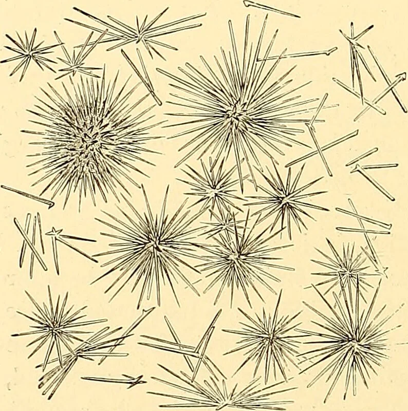 An illustration from Clinical diagnosis : the bacteriological, chemical, and microscopical evidence of disease / by Rudolf v. Jaksch ; tr. from the 3rd German ed. and enlarged by James Cagney ; with numerous illustrations (partly in colours)., 1893, leaf 274