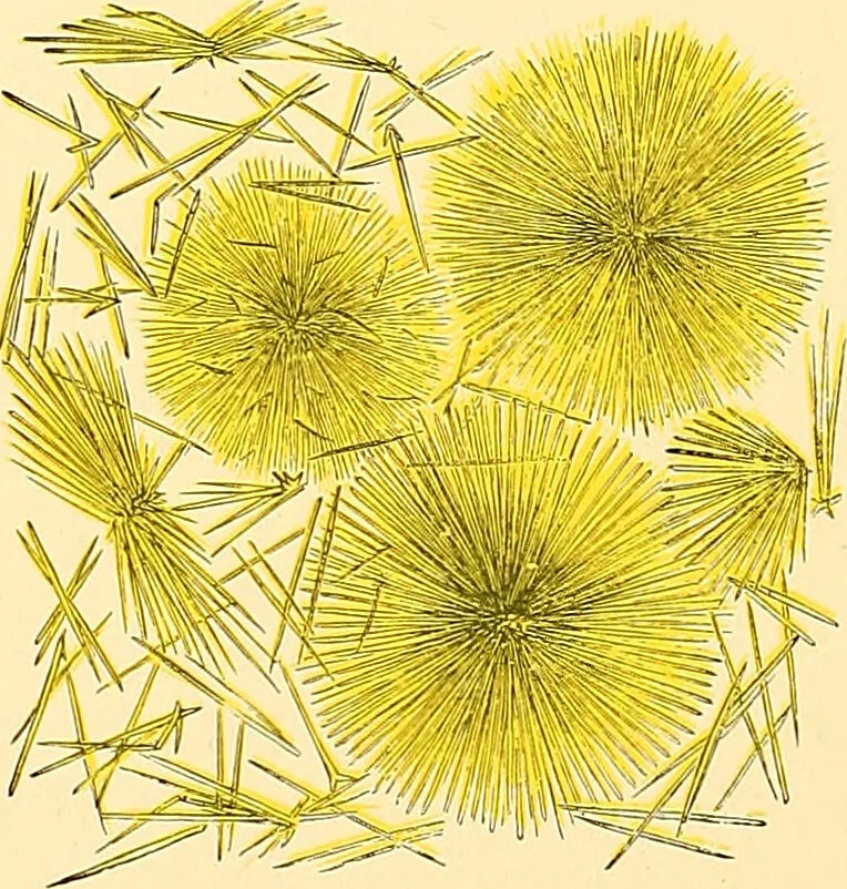 An illustration from Clinical diagnosis : the bacteriological, chemical, and microscopical evidence of disease / by Rudolf v. Jaksch ; tr. from the 3rd German ed. and enlarged by James Cagney ; with numerous illustrations (partly in colours)., 1893, leaf 304