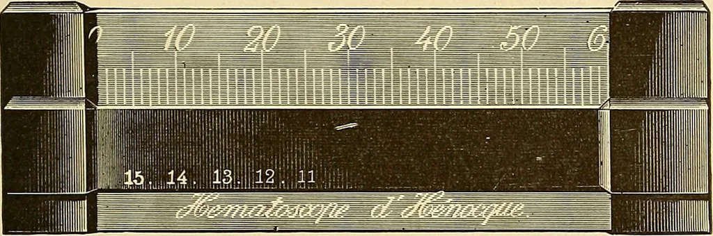 An illustration from Clinical diagnosis : the bacteriological, chemical, and microscopical evidence of disease / by Rudolf v. Jaksch ; tr. from the 3rd German ed. and enlarged by James Cagney ; with numerous illustrations (partly in colours)., 1893, leaf 49