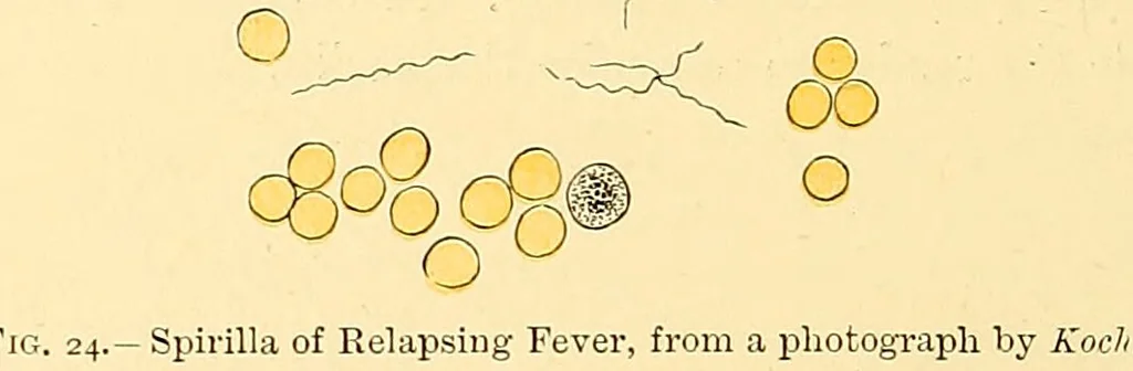 An illustration from Clinical diagnosis : the bacteriological, chemical, and microscopical evidence of disease / by Rudolf v. Jaksch ; tr. from the 3rd German ed. and enlarged by James Cagney ; with numerous illustrations (partly in colours)., 1893, leaf 72