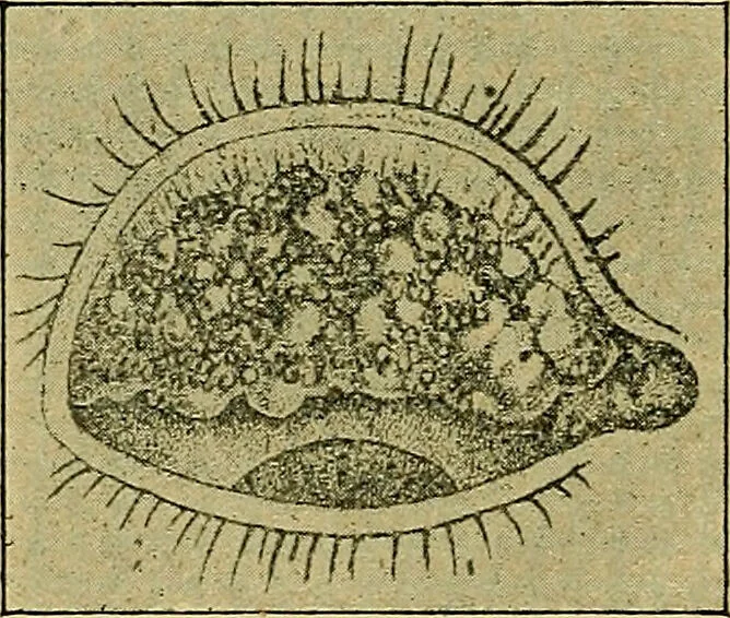 An illustration from Diseases of the eye / by Edward Nettleship ; with a supplement on examinations for color-blindness and acuity of vision and hearing, by William Thomson ; with 5 colored plates and 192 engravings., 1900, leaf 120