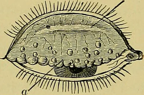 An illustration from Diseases of the eye / by Edward Nettleship ; with a supplement on examinations for color-blindness and acuity of vision and hearing, by William Thomson ; with 5 colored plates and 192 engravings., 1900, leaf 124