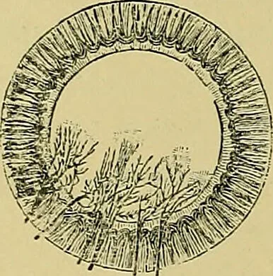 An illustration from Diseases of the eye / by Edward Nettleship ; with a supplement on examinations for color-blindness and acuity of vision and hearing, by William Thomson ; with 5 colored plates and 192 engravings., 1900, leaf 150