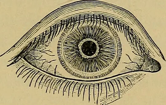 An illustration from Diseases of the eye / by Edward Nettleship ; with a supplement on examinations for color-blindness and acuity of vision and hearing, by William Thomson ; with 5 colored plates and 192 engravings., 1900, leaf 157