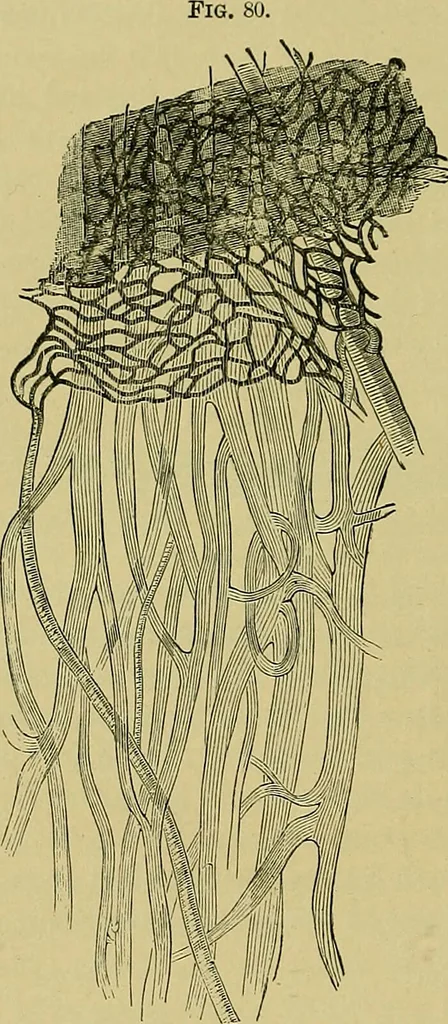 An illustration from Diseases of the eye / by Edward Nettleship ; with a supplement on examinations for color-blindness and acuity of vision and hearing, by William Thomson ; with 5 colored plates and 192 engravings., 1900, leaf 222