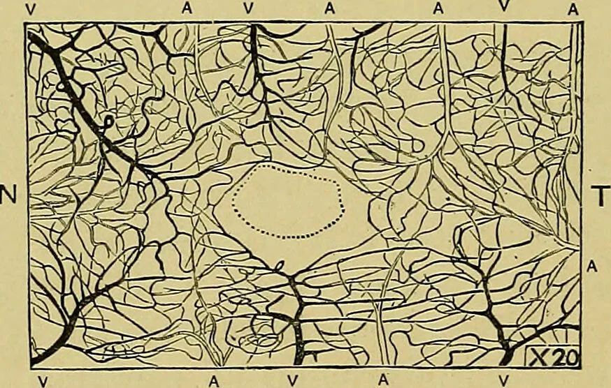 An illustration from Diseases of the eye / by Edward Nettleship ; with a supplement on examinations for color-blindness and acuity of vision and hearing, by William Thomson ; with 5 colored plates and 192 engravings., 1900, leaf 238