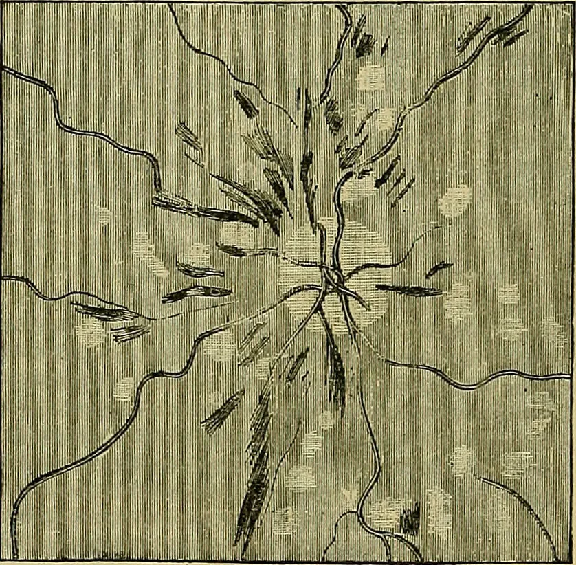 An illustration from Diseases of the eye / by Edward Nettleship ; with a supplement on examinations for color-blindness and acuity of vision and hearing, by William Thomson ; with 5 colored plates and 192 engravings., 1900, leaf 242
