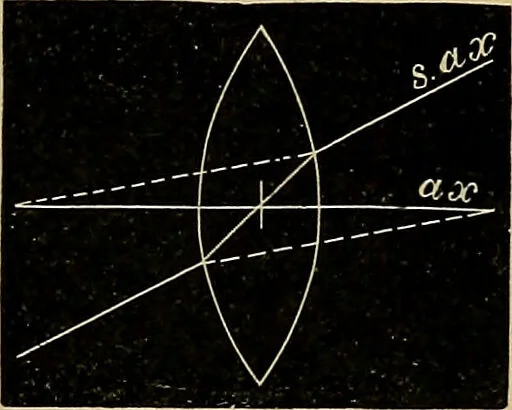 An illustration from Diseases of the eye / by Edward Nettleship ; with a supplement on examinations for color-blindness and acuity of vision and hearing, by William Thomson ; with 5 colored plates and 192 engravings., 1900, leaf 27