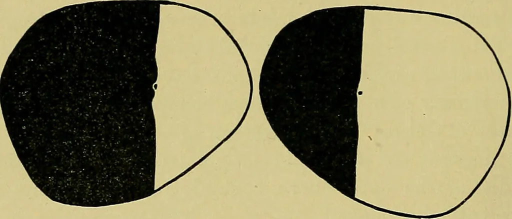 An illustration from Diseases of the eye / by Edward Nettleship ; with a supplement on examinations for color-blindness and acuity of vision and hearing, by William Thomson ; with 5 colored plates and 192 engravings., 1900, leaf 288