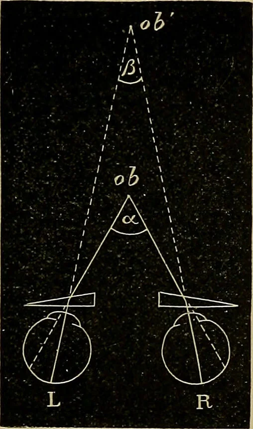 An illustration from Diseases of the eye / by Edward Nettleship ; with a supplement on examinations for color-blindness and acuity of vision and hearing, by William Thomson ; with 5 colored plates and 192 engravings., 1900, leaf 33