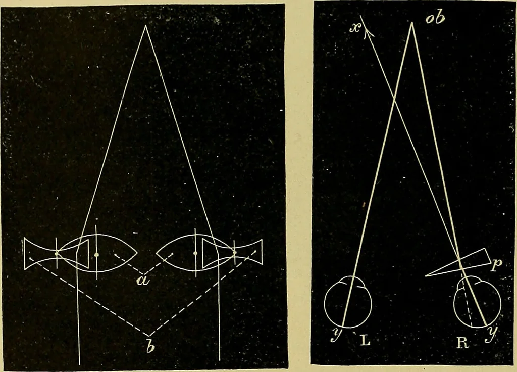 An illustration from Diseases of the eye / by Edward Nettleship ; with a supplement on examinations for color-blindness and acuity of vision and hearing, by William Thomson ; with 5 colored plates and 192 engravings., 1900, leaf 34