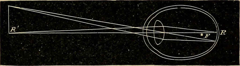 An illustration from Diseases of the eye / by Edward Nettleship ; with a supplement on examinations for color-blindness and acuity of vision and hearing, by William Thomson ; with 5 colored plates and 192 engravings., 1900, leaf 343