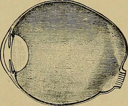 An illustration from Diseases of the eye / by Edward Nettleship ; with a supplement on examinations for color-blindness and acuity of vision and hearing, by William Thomson ; with 5 colored plates and 192 engravings., 1900, leaf 345