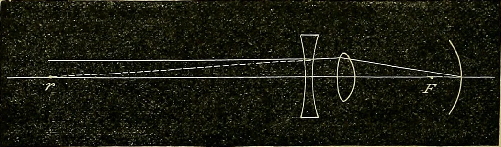 An illustration from Diseases of the eye / by Edward Nettleship ; with a supplement on examinations for color-blindness and acuity of vision and hearing, by William Thomson ; with 5 colored plates and 192 engravings., 1900, leaf 352