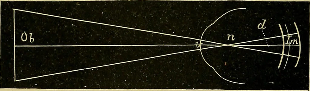 An illustration from Diseases of the eye / by Edward Nettleship ; with a supplement on examinations for color-blindness and acuity of vision and hearing, by William Thomson ; with 5 colored plates and 192 engravings., 1900, leaf 36