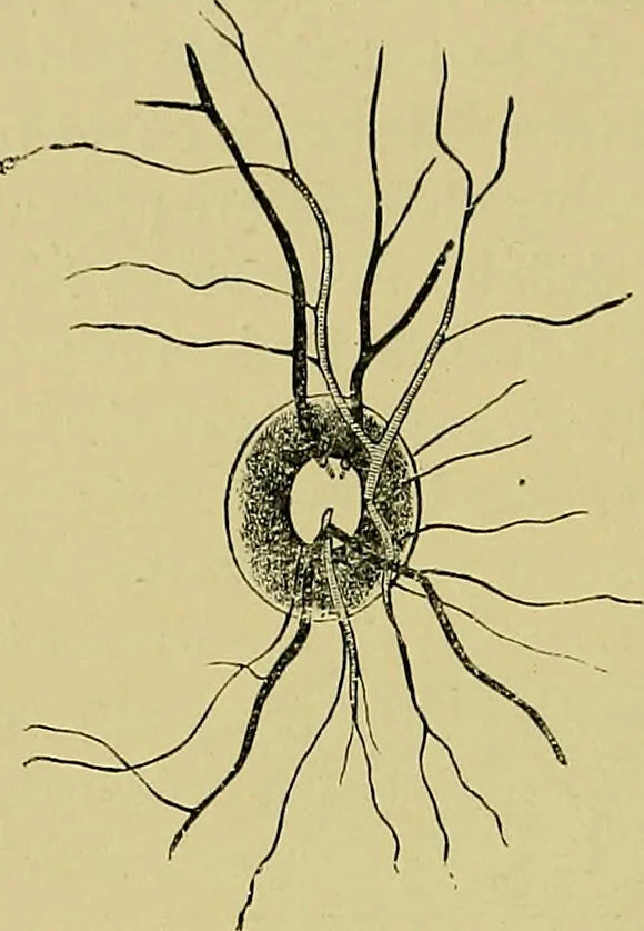 An illustration from Diseases of the eye / by Edward Nettleship ; with a supplement on examinations for color-blindness and acuity of vision and hearing, by William Thomson ; with 5 colored plates and 192 engravings., 1900, leaf 368