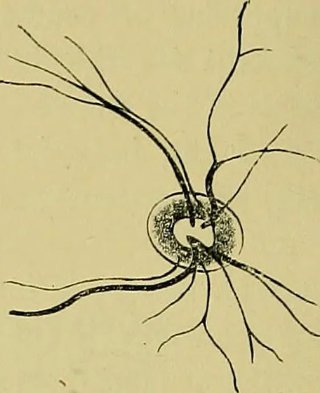 An illustration from Diseases of the eye / by Edward Nettleship ; with a supplement on examinations for color-blindness and acuity of vision and hearing, by William Thomson ; with 5 colored plates and 192 engravings., 1900, leaf 368