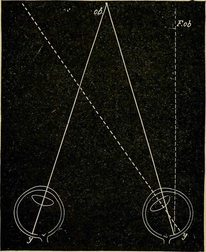 An illustration from Diseases of the eye / by Edward Nettleship ; with a supplement on examinations for color-blindness and acuity of vision and hearing, by William Thomson ; with 5 colored plates and 192 engravings., 1900, leaf 378