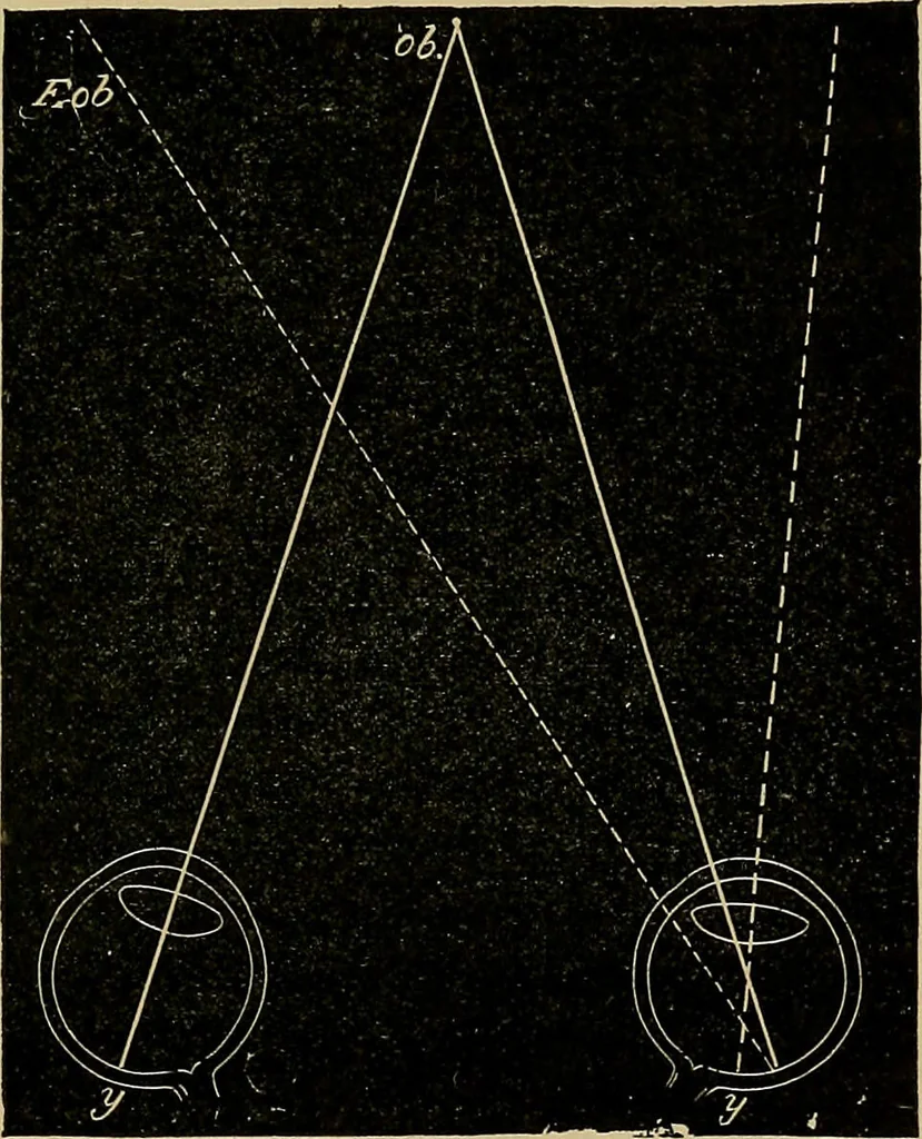 An illustration from Diseases of the eye / by Edward Nettleship ; with a supplement on examinations for color-blindness and acuity of vision and hearing, by William Thomson ; with 5 colored plates and 192 engravings., 1900, leaf 379