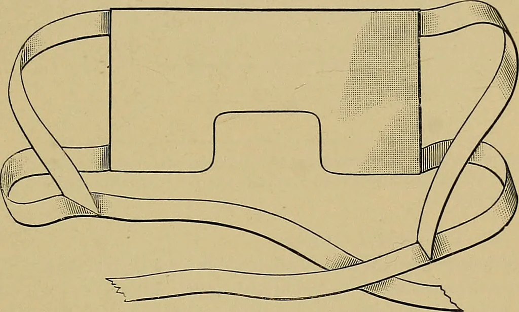 An illustration from Diseases of the eye / by Edward Nettleship ; with a supplement on examinations for color-blindness and acuity of vision and hearing, by William Thomson ; with 5 colored plates and 192 engravings., 1900, leaf 541