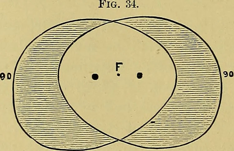 An illustration from Diseases of the eye / by Edward Nettleship ; with a supplement on examinations for color-blindness and acuity of vision and hearing, by William Thomson ; with 5 colored plates and 192 engravings., 1900, leaf 62