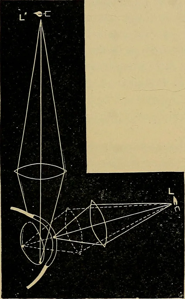 An illustration from Diseases of the eye / by Edward Nettleship ; with a supplement on examinations for color-blindness and acuity of vision and hearing, by William Thomson ; with 5 colored plates and 192 engravings., 1900, leaf 65