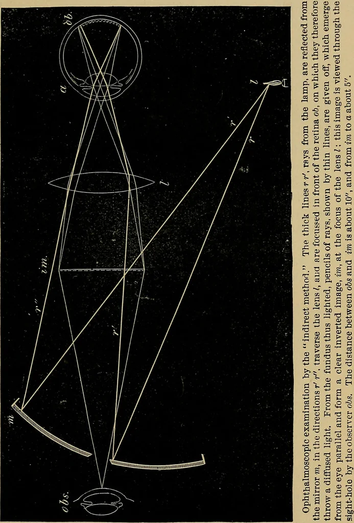 An illustration from Diseases of the eye / by Edward Nettleship ; with a supplement on examinations for color-blindness and acuity of vision and hearing, by William Thomson ; with 5 colored plates and 192 engravings., 1900, leaf 69