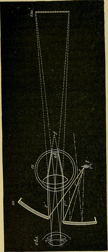 An illustration from Diseases of the eye / by Edward Nettleship ; with a supplement on examinations for color-blindness and acuity of vision and hearing, by William Thomson ; with 5 colored plates and 192 engravings., 1900, leaf 76