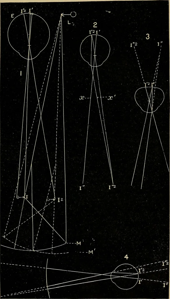 An illustration from Diseases of the eye / by Edward Nettleship ; with a supplement on examinations for color-blindness and acuity of vision and hearing, by William Thomson ; with 5 colored plates and 192 engravings., 1900, leaf 83