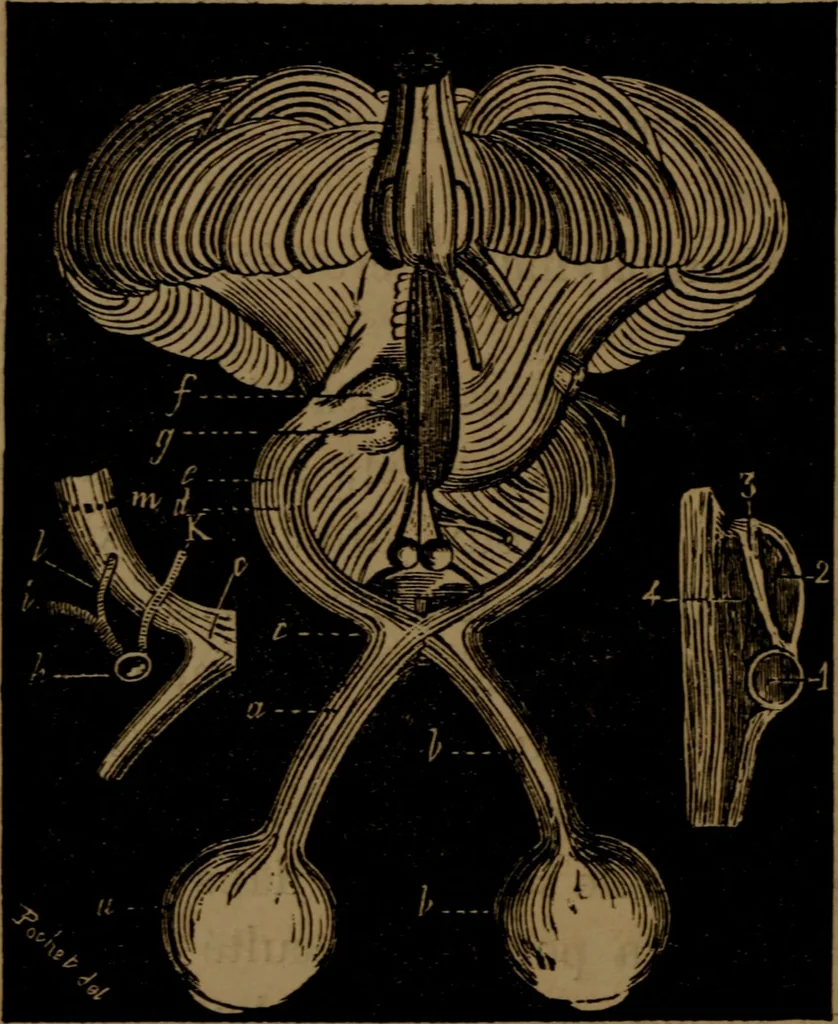 An illustration from Des altérations de l'oeil dans l'albuminurie et le diabète / par Mohammed Off ; avec planches en chromolithographie., 1870, leaf 178
