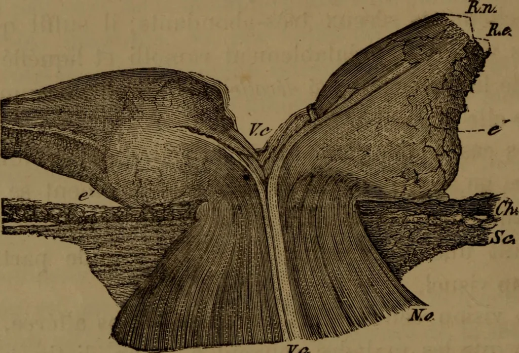 An illustration from Des altérations de l'oeil dans l'albuminurie et le diabète / par Mohammed Off ; avec planches en chromolithographie., 1870, leaf 26