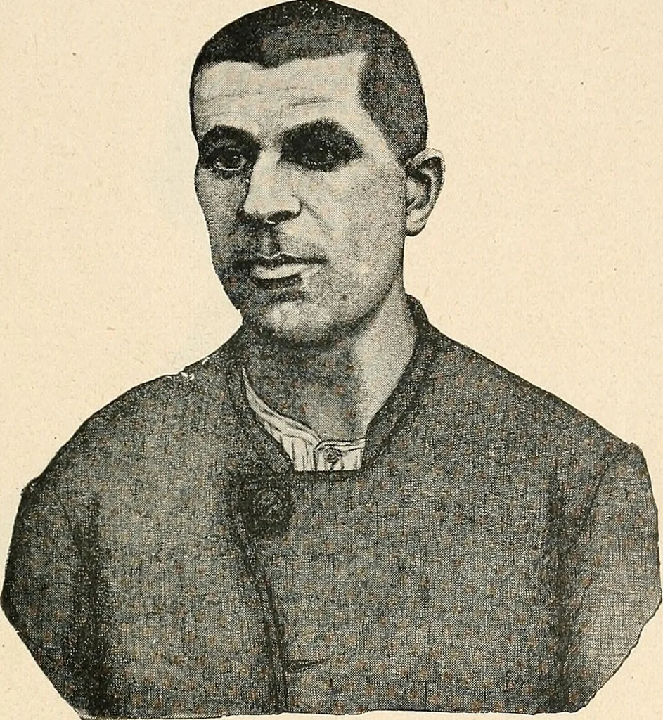 An illustration from Les criminels : ude concernant 859 condamn / par le Dr. Charles Perrier., 1900, leaf 431