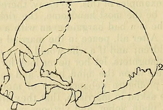 An illustration from The principles of phrenology / by Sidney Smith., 1838, leaf 102
