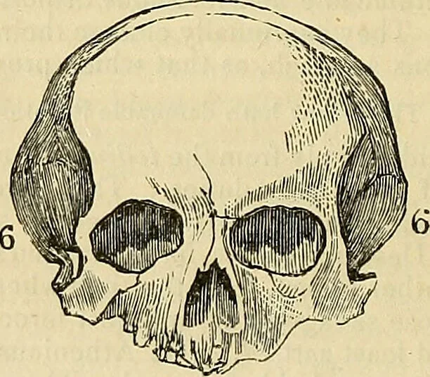 An illustration from The principles of phrenology / by Sidney Smith., 1838, leaf 128
