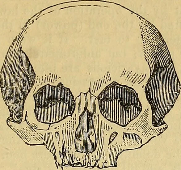 An illustration from The principles of phrenology / by Sidney Smith., 1838, leaf 137
