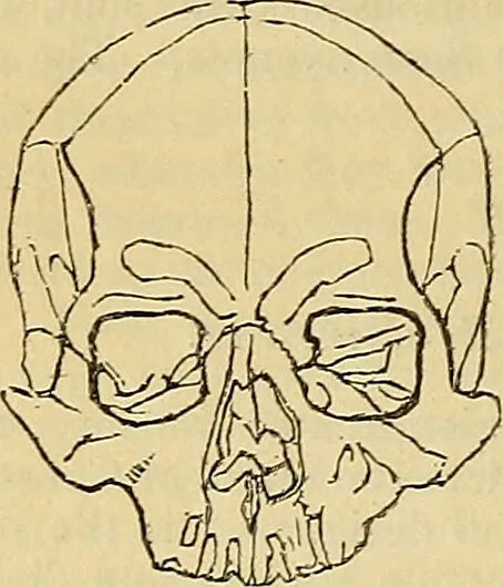 An illustration from The principles of phrenology / by Sidney Smith., 1838, leaf 144