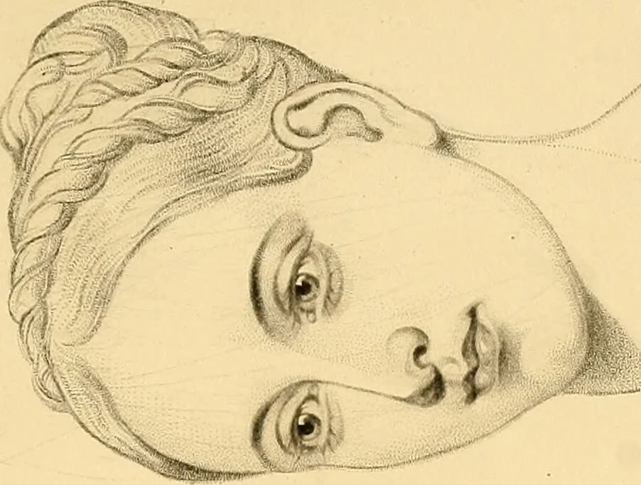 An illustration from The study of the human face / by Thomas Woolnoth., 1865, leaf 239