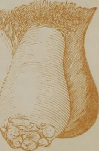 An illustration from Medical adviser and marriage guide : representing all the diseases of the genital organs of the male and female / by M. Larmont., 1854, leaf 111
