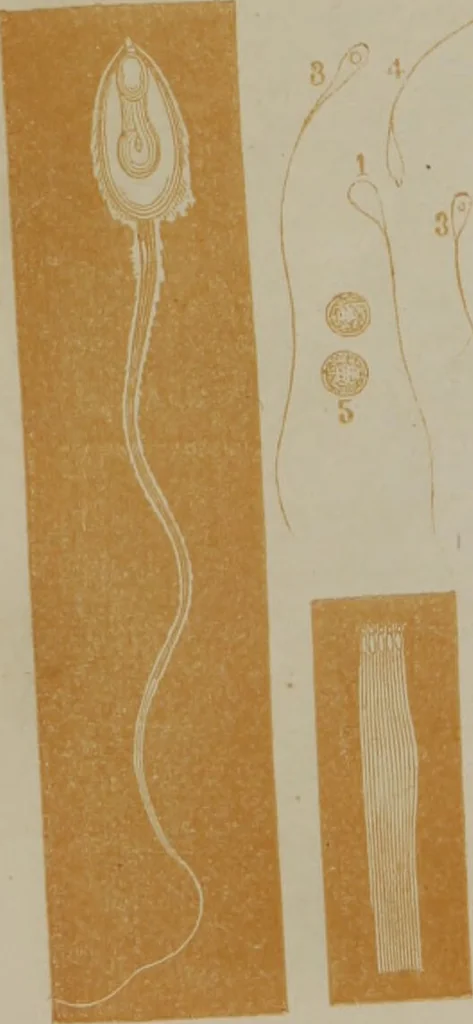 An illustration from Medical adviser and marriage guide : representing all the diseases of the genital organs of the male and female / by M. Larmont., 1854, leaf 206