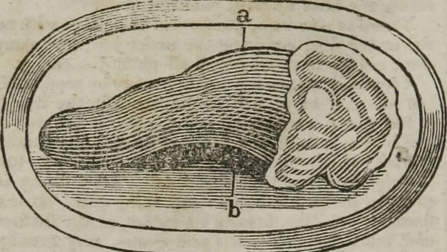 An illustration from MacKenzie's five thousand receipts in all the useful and domestic arts : constituting a complete practical library ... : a new American, from the latest London edition : with numerous and important additions generally : and the medical part carefully revised and adapted to the climate of the U. States : and also a new and most copious index / by an American physician., 1829, leaf 426
