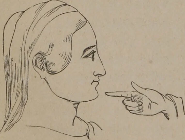 An illustration from Outlines of a new system of physiognomy : illustrated by numerous engravings indicating the location of the signs of the different mental faculties / by J.W. Redfield., 1849, leaf 22