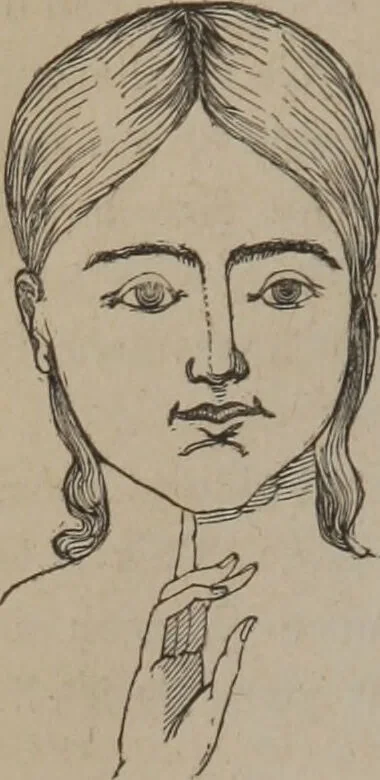 An illustration from Outlines of a new system of physiognomy : illustrated by numerous engravings indicating the location of the signs of the different mental faculties / by J.W. Redfield., 1849, leaf 24
