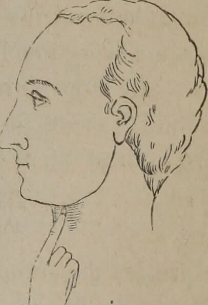 An illustration from Outlines of a new system of physiognomy : illustrated by numerous engravings indicating the location of the signs of the different mental faculties / by J.W. Redfield., 1849, leaf 31