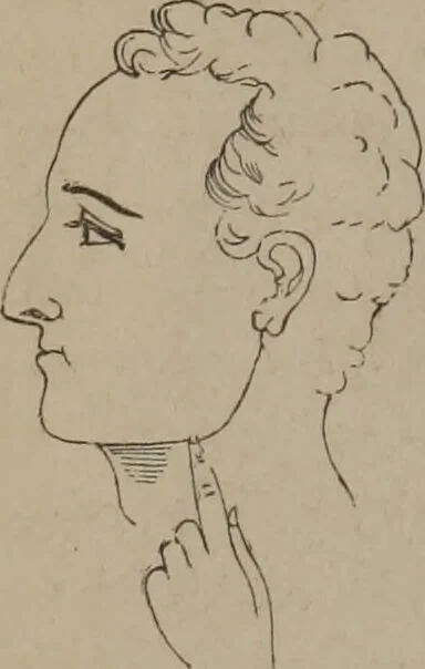 An illustration from Outlines of a new system of physiognomy : illustrated by numerous engravings indicating the location of the signs of the different mental faculties / by J.W. Redfield., 1849, leaf 32