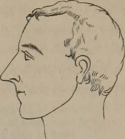 An illustration from Outlines of a new system of physiognomy : illustrated by numerous engravings indicating the location of the signs of the different mental faculties / by J.W. Redfield., 1849, leaf 32