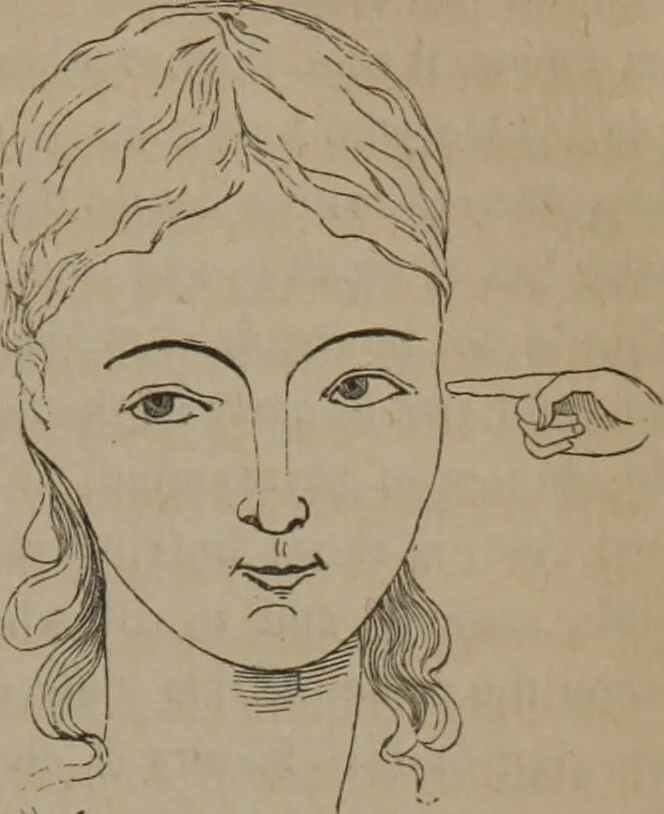 An illustration from Outlines of a new system of physiognomy : illustrated by numerous engravings indicating the location of the signs of the different mental faculties / by J.W. Redfield., 1849, leaf 39