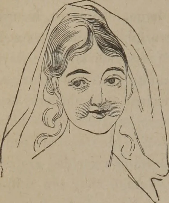 An illustration from Outlines of a new system of physiognomy : illustrated by numerous engravings indicating the location of the signs of the different mental faculties / by J.W. Redfield., 1849, leaf 72