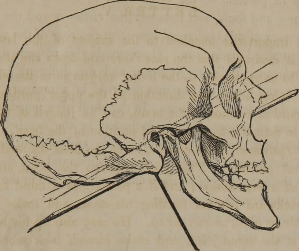 An illustration from The twelve qualities of mind, or, Outlines of a new system of physiognomy, no. II / by J.W. Redfield., 1850, leaf 31